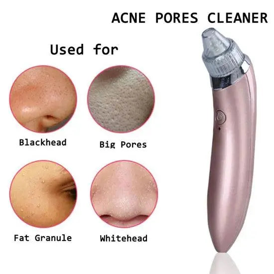 Blackhead Remover Facial Cleaner Techni Product